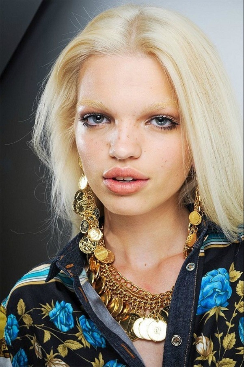 Models with defects in appearance: ugliness or a highlight? Models with defects in appearance: ugliness or a highlight?