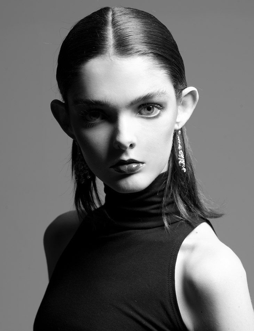 Models with defects in appearance: ugliness or a highlight? Models with defects in appearance: ugliness or a highlight?