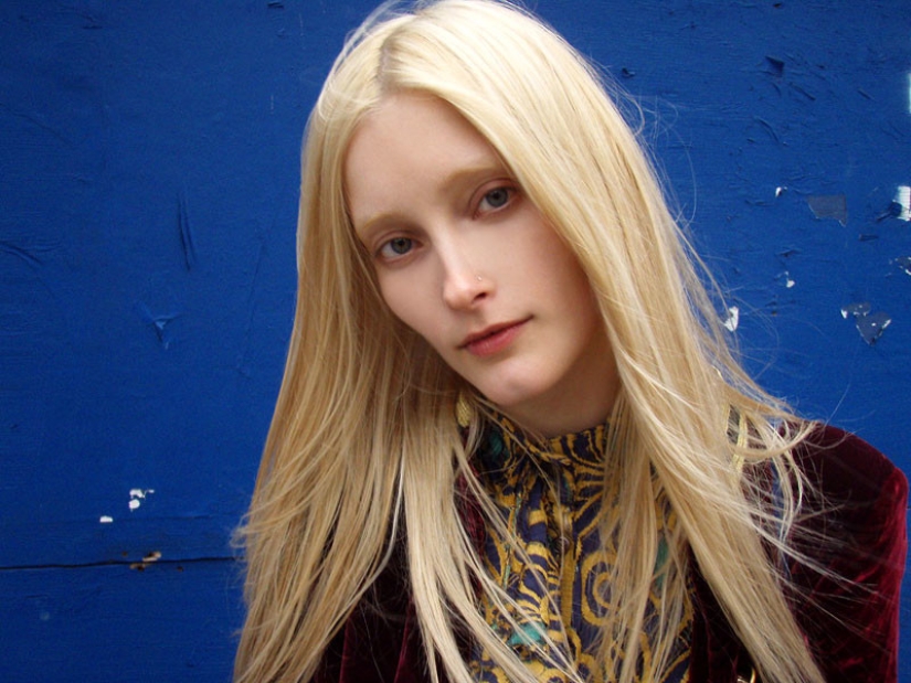 Models with defects in appearance: ugliness or a highlight? Models with defects in appearance: ugliness or a highlight?