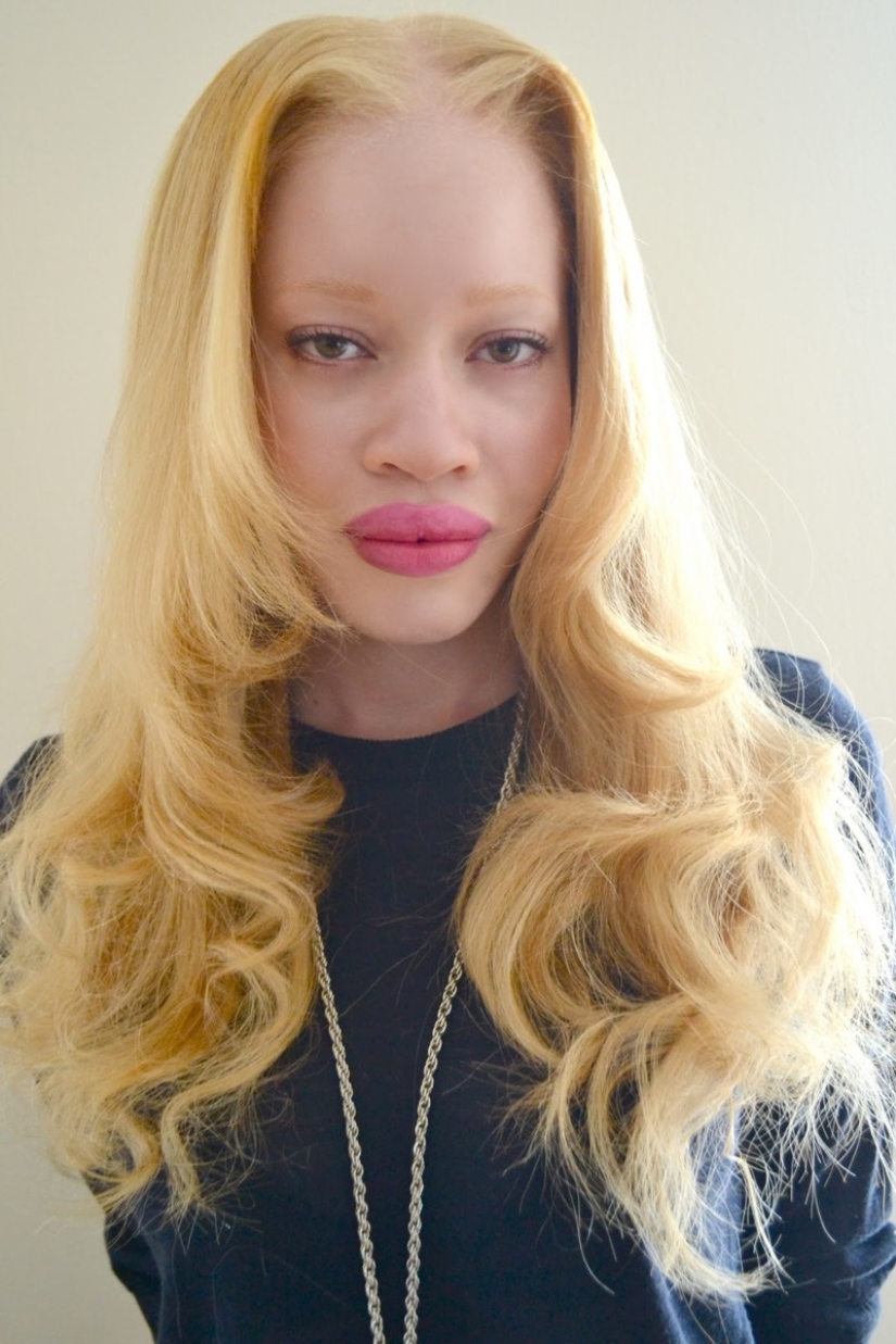 Models with defects in appearance: ugliness or a highlight? Models with defects in appearance: ugliness or a highlight?