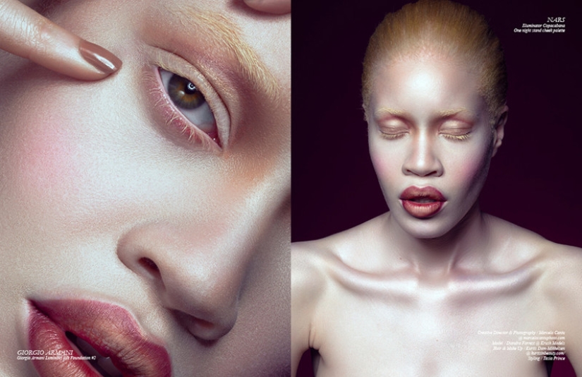 Models with defects in appearance: ugliness or a highlight? Models with defects in appearance: ugliness or a highlight?