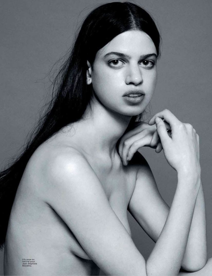 Models with defects in appearance: ugliness or a highlight? Models with defects in appearance: ugliness or a highlight?