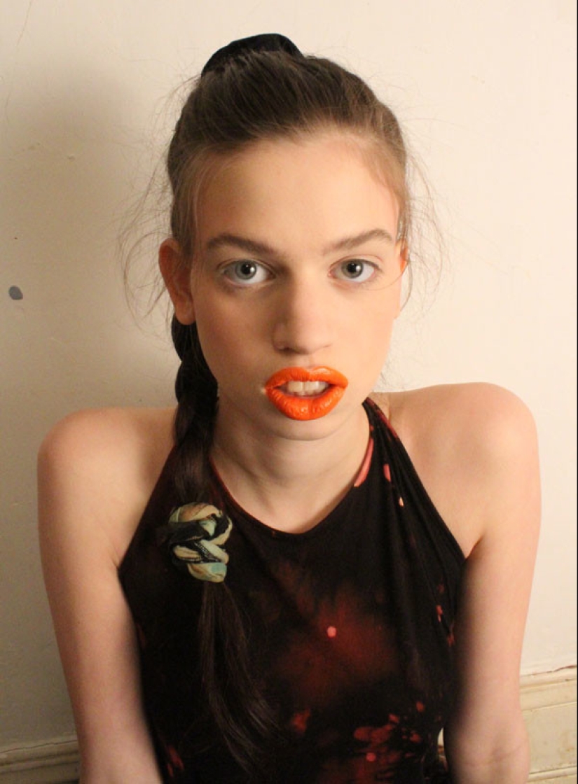 Models with defects in appearance: ugliness or a highlight? Models with defects in appearance: ugliness or a highlight?