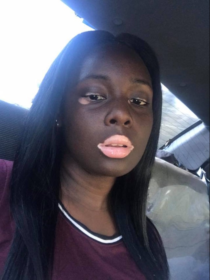 No como todos los demás: 22 fotos de personas a las que la naturaleza ha hecho diferente de los demás No como todos los demás: 22 fotos de personas a las que la naturaleza ha hecho diferente de los demás