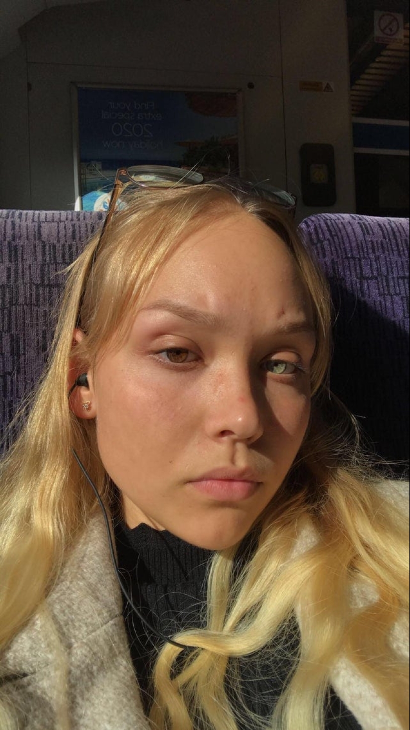 No como todos los demás: 22 fotos de personas a las que la naturaleza ha hecho diferente de los demás No como todos los demás: 22 fotos de personas a las que la naturaleza ha hecho diferente de los demás