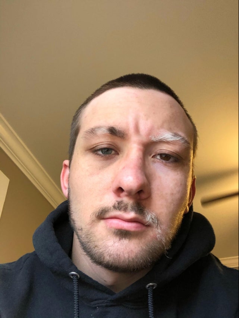 No como todos los demás: 22 fotos de personas a las que la naturaleza ha hecho diferente de los demás No como todos los demás: 22 fotos de personas a las que la naturaleza ha hecho diferente de los demás