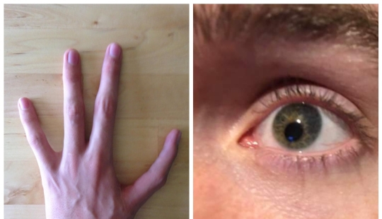 Not like everyone else: 22 photos of people whom nature has made different from others Not like everyone else: 22 photos of people whom nature has made different from others