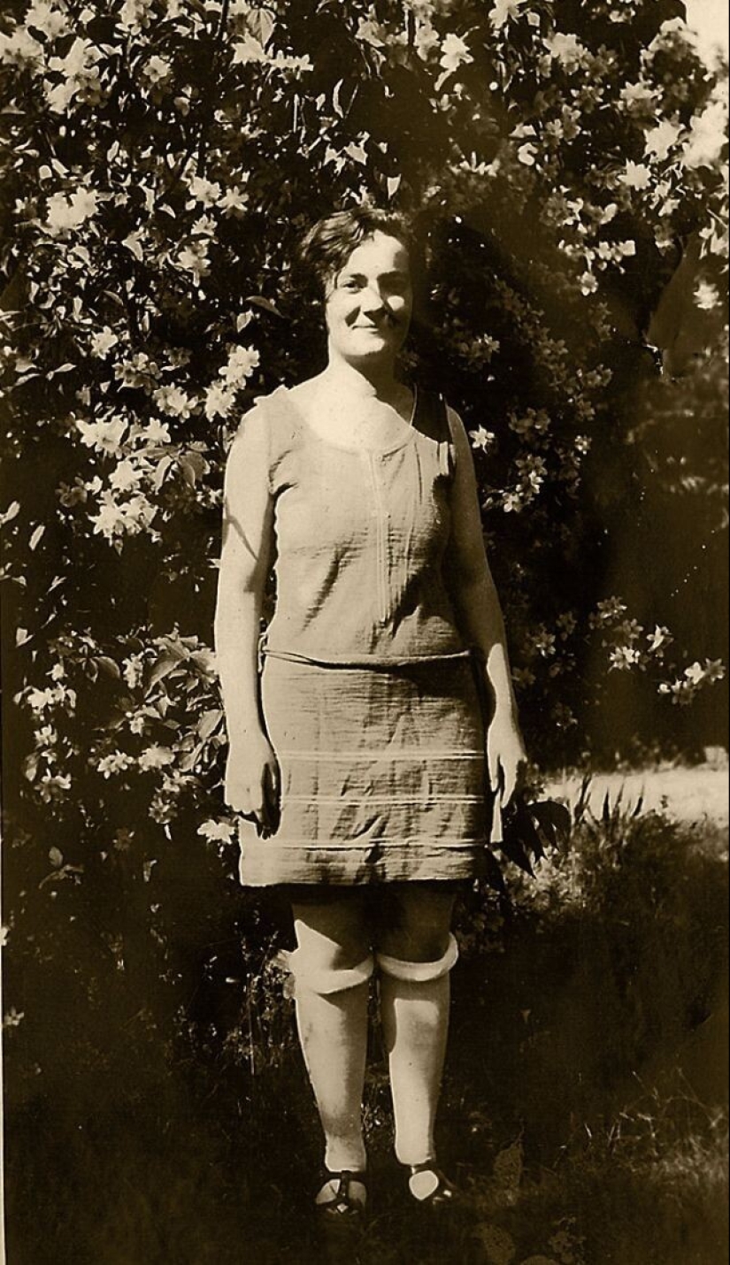 Obscene fashion of a century ago - stockings rolled up under the knee