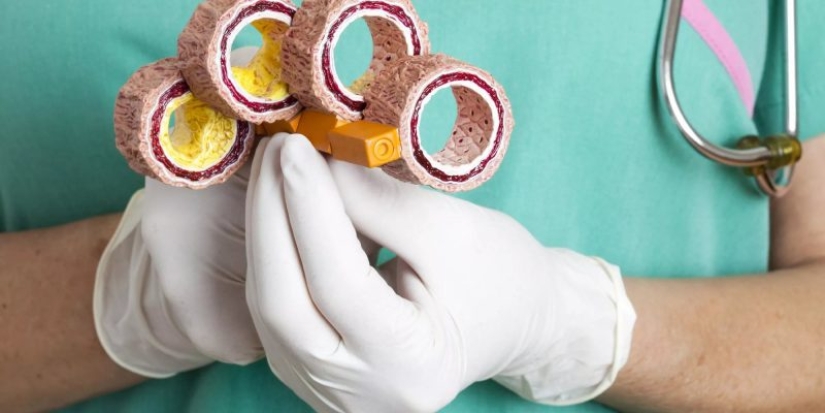 Palm oil exposed: World Health Organization report