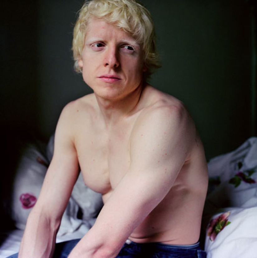 Paola de Grene's Albinos