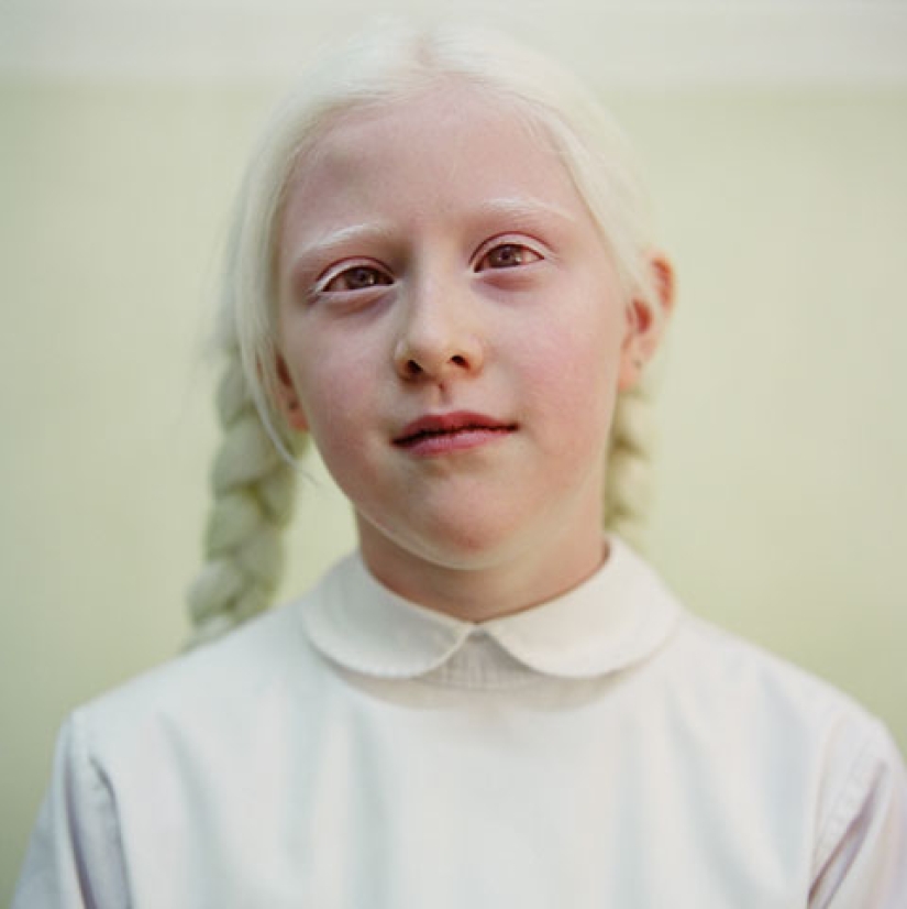 Paola de Grene's Albinos