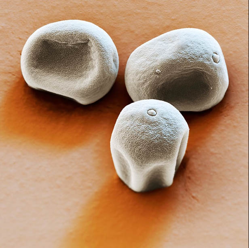 Polen bajo el microscopio