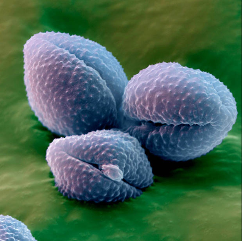 Polen bajo el microscopio