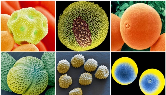 Pollen under a microscope