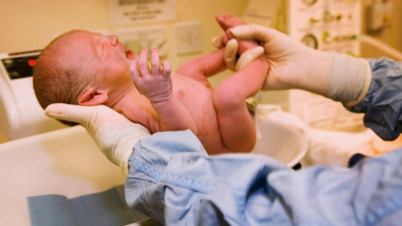 ¿Por qué es tan popular la circuncisión en los Estados Unidos? Y no se trata de higiene o religión en absoluto