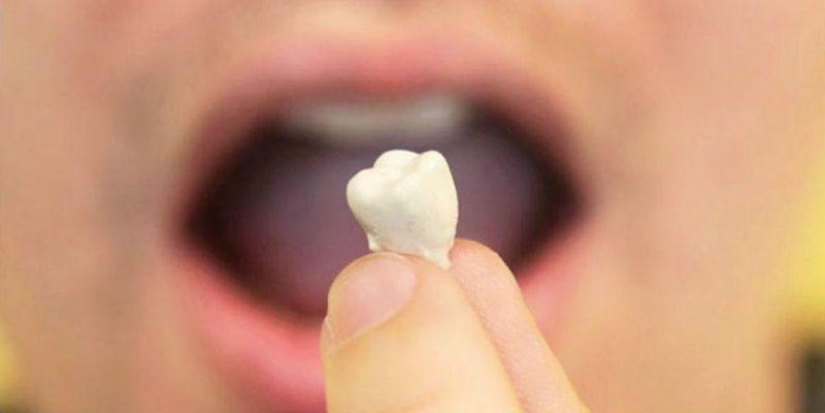 ¿Por qué sueñas con la pérdida de dientes