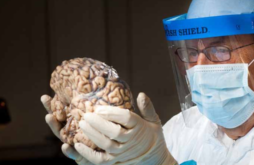 Prion diseases, which slowly and painfully die in 100% of cases Prion diseases, which slowly and painfully die in 100% of cases