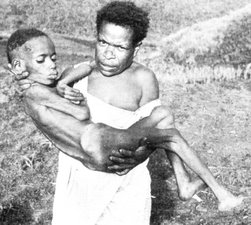 Prion diseases, which slowly and painfully die in 100% of cases Prion diseases, which slowly and painfully die in 100% of cases