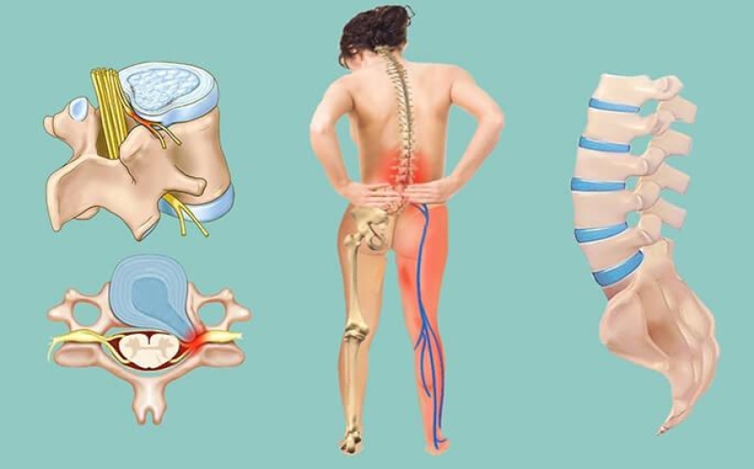 ¿Qué es la "deuda de dolor" Ko Matsudaira, o de Cómo quitar el malestar en la parte de atrás de 3 segundos ¿Qué es la "deuda de dolor" Ko Matsudaira, o de Cómo quitar el malestar en la parte de atrás de 3 segundos