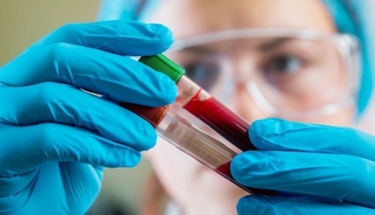 "Sangre dorada" con un factor Rh cero: por qué es saludable y peligroso a la vez