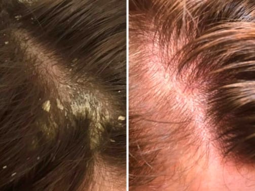 Sin photoshop: 26 de mercancías de las tiendas en línea que han confirmado su eficacia