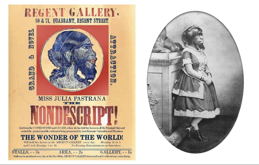 Sobre la cara de lo terrible, amable por dentro: la vida y muerte de la barbuda Julia, la mujer simio de México