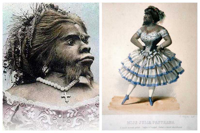 Sobre la cara de lo terrible, amable por dentro: la vida y muerte de la barbuda Julia, la mujer simio de México