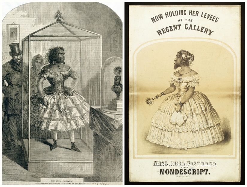 Sobre la cara de lo terrible, amable por dentro: la vida y muerte de la barbuda Julia, la mujer simio de México