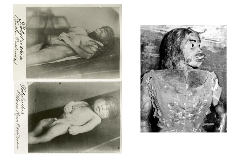 Sobre la cara de lo terrible, amable por dentro: la vida y muerte de la barbuda Julia, la mujer simio de México