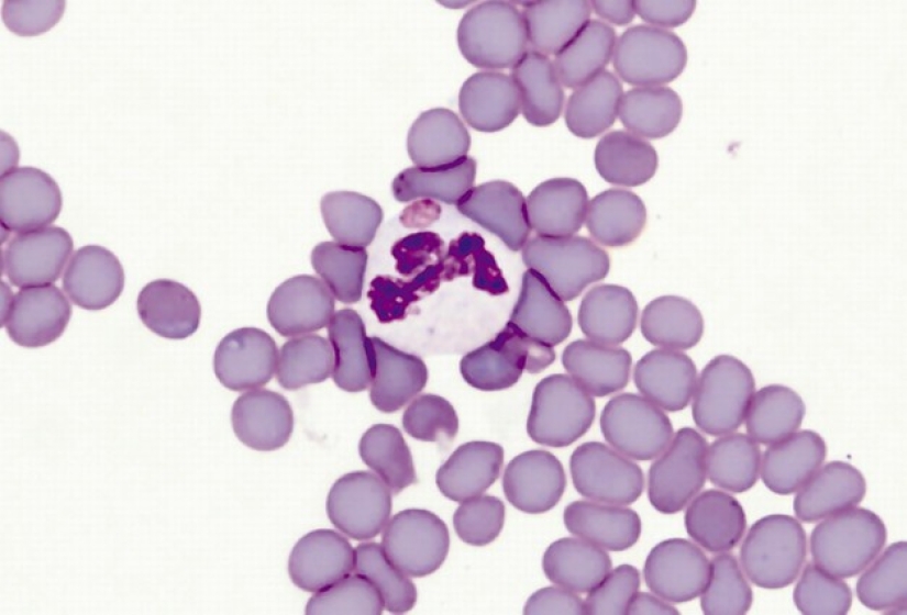 Summer literacy: what you get from the arthropods on a normal walk