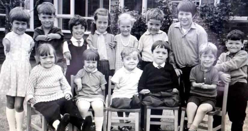 Talidomida tragedia, o Como una "píldora milagrosa" para destruir a los cuerpos y vidas de las personas Talidomida tragedia, o Como una "píldora milagrosa" para destruir a los cuerpos y vidas de las personas