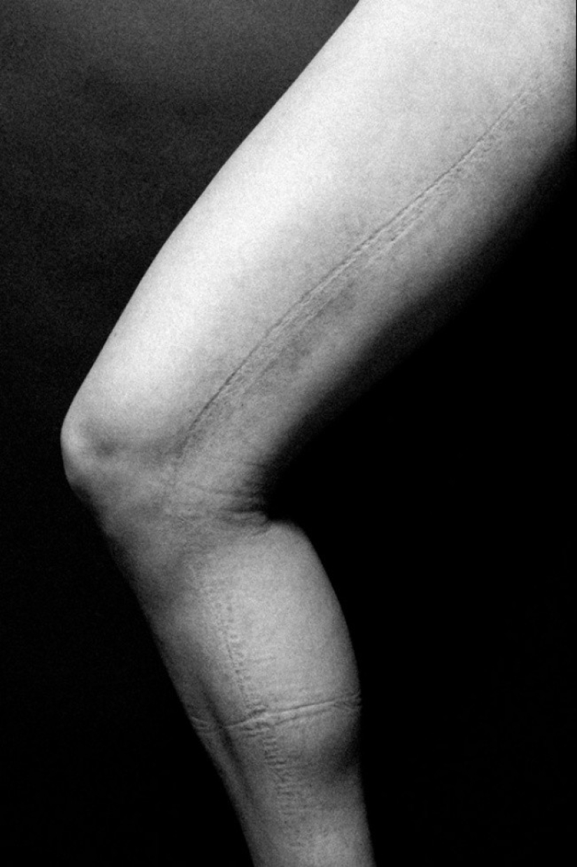 That's what lies behind the feminine splendor. It's even painful to look at these photos That's what lies behind the feminine splendor. It's even painful to look at these photos