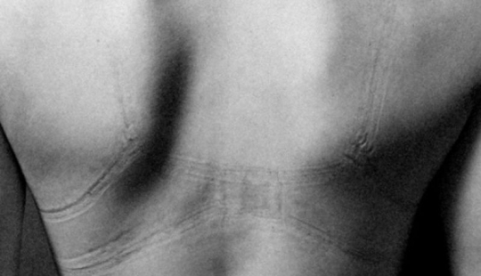 That's what lies behind the feminine splendor. It's even painful to look at these photos That's what lies behind the feminine splendor. It's even painful to look at these photos