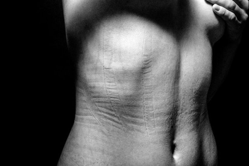 That's what lies behind the feminine splendor. It's even painful to look at these photos That's what lies behind the feminine splendor. It's even painful to look at these photos