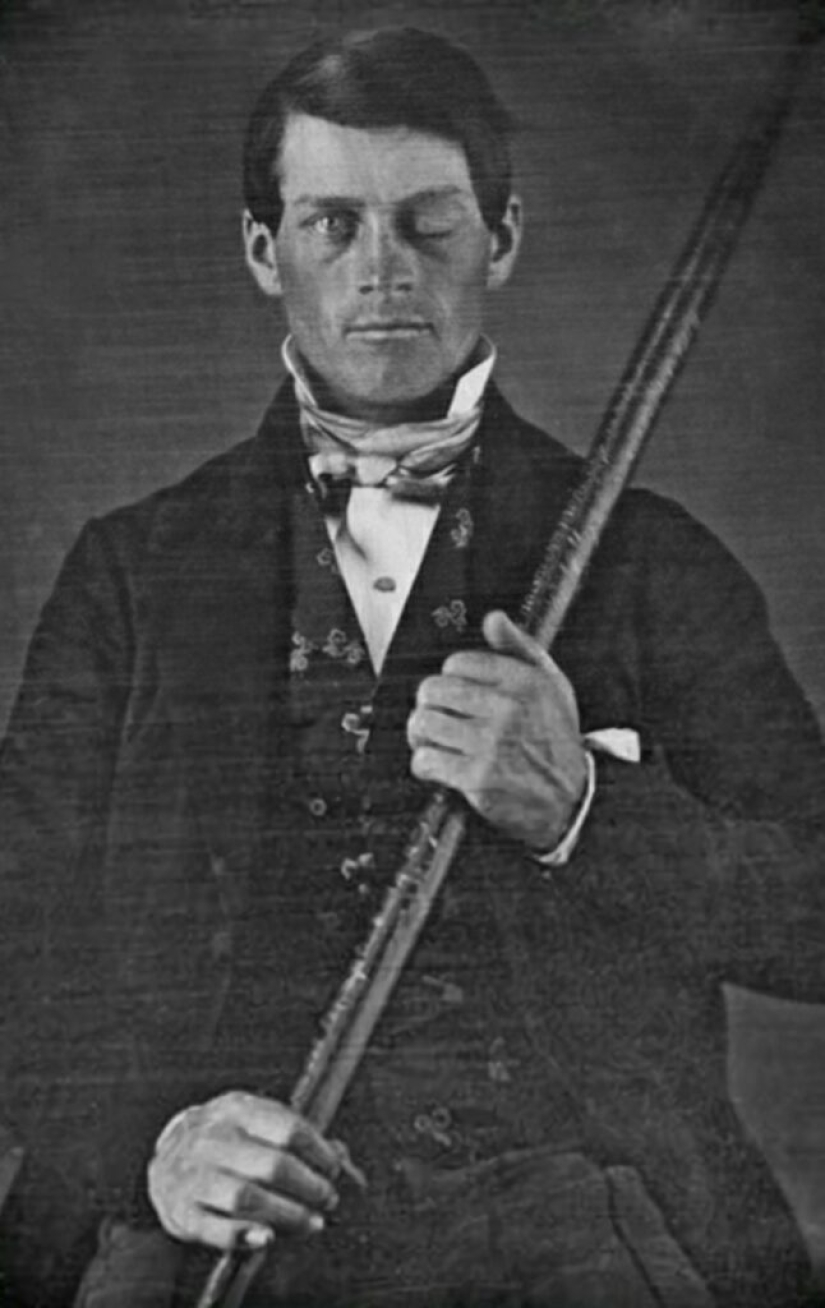 The amazing story of Phineas Gage - the man with the crowbar in his skull