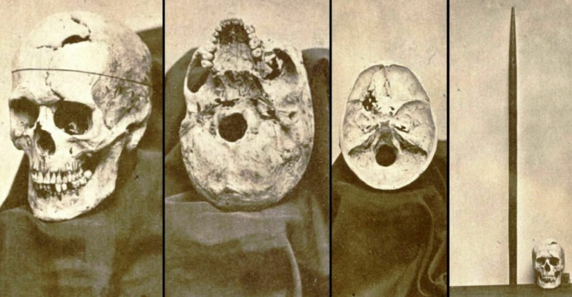 The amazing story of Phineas Gage - the man with the crowbar in his skull