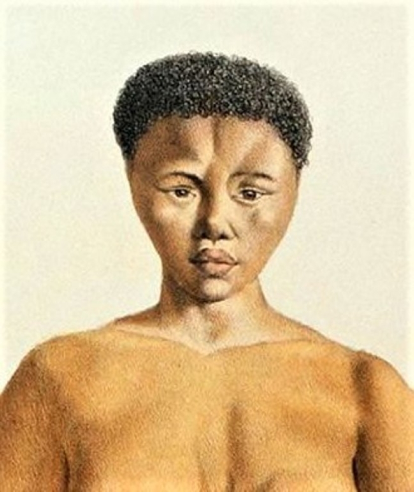 The Black Venus Story: The Tragic Fate of &quot;Exhibit Man&quot; Saartjie Baartman