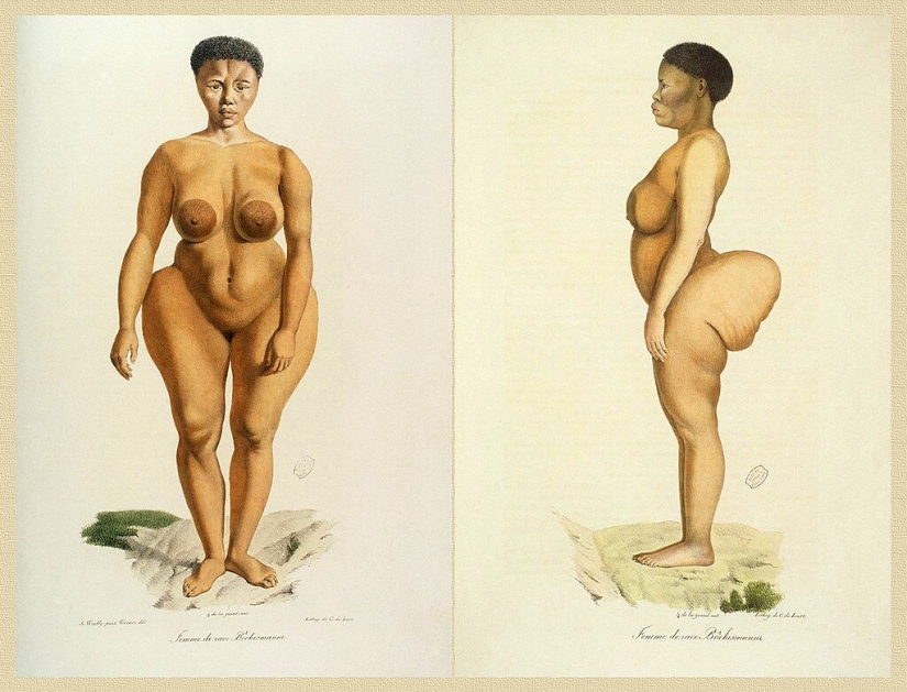 The Black Venus Story: The Tragic Fate of &quot;Exhibit Man&quot; Saartjie Baartman