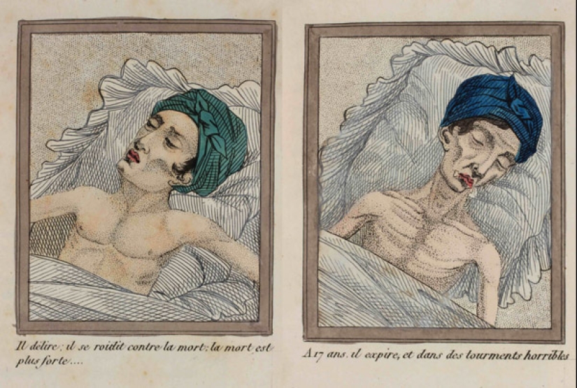 The lost War: how humanity has struggled with masturbation in different eras The lost War: how humanity has struggled with masturbation in different eras