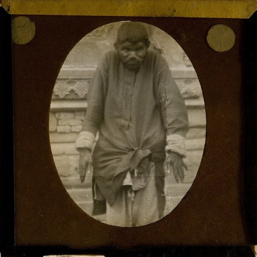 The most famous child Mowgli: what happened to kids who grew up among animals