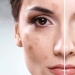 The result is obvious: as computers and smartphones spoil your skin