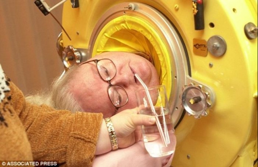 The story of Martha Mason-a woman who lived 60 years in a capsule