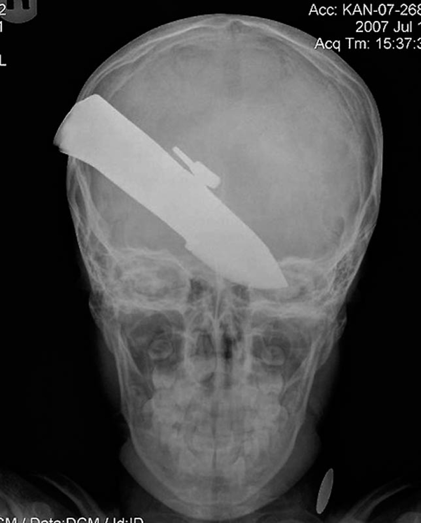 The strangest X-rays