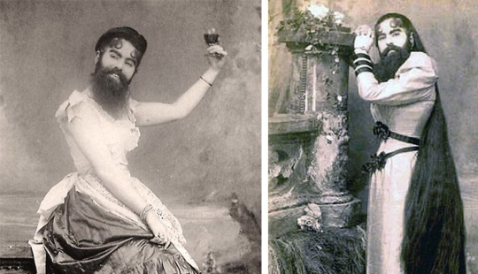 The tragic life of bearded women Annie Jones, who was a real lady