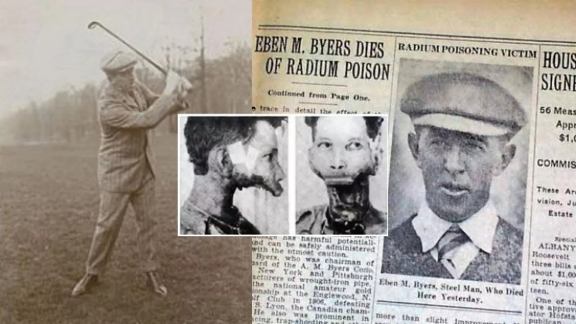 The tragic story of Eben Byers, who was treated with radium