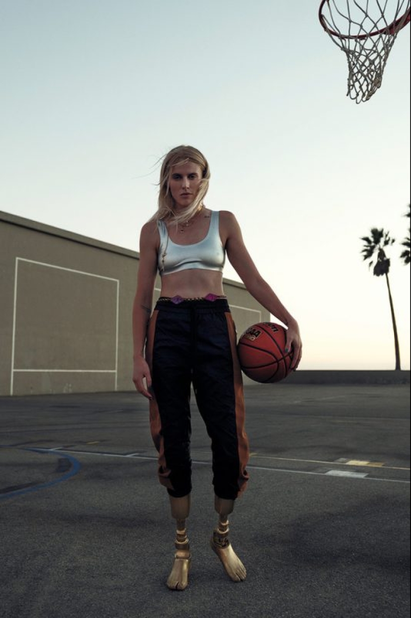 The tragic story of Lauren Wasser, who lost her legs after using tampons