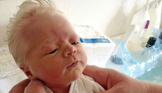 Toddlers who look like little old men