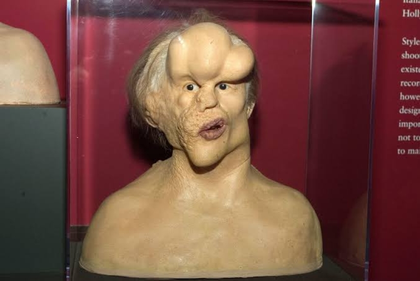 Un Fenómeno con un Alma Hermosa: La historia de Joseph Merrick - El Hombre Elefante Un Fenómeno con un Alma Hermosa: La historia de Joseph Merrick - El Hombre Elefante