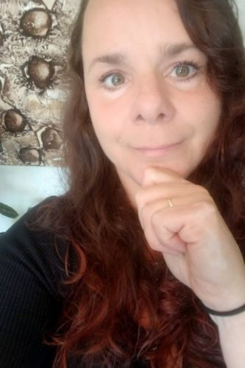 Una coleta para el cabello casi incapacita a una mujer