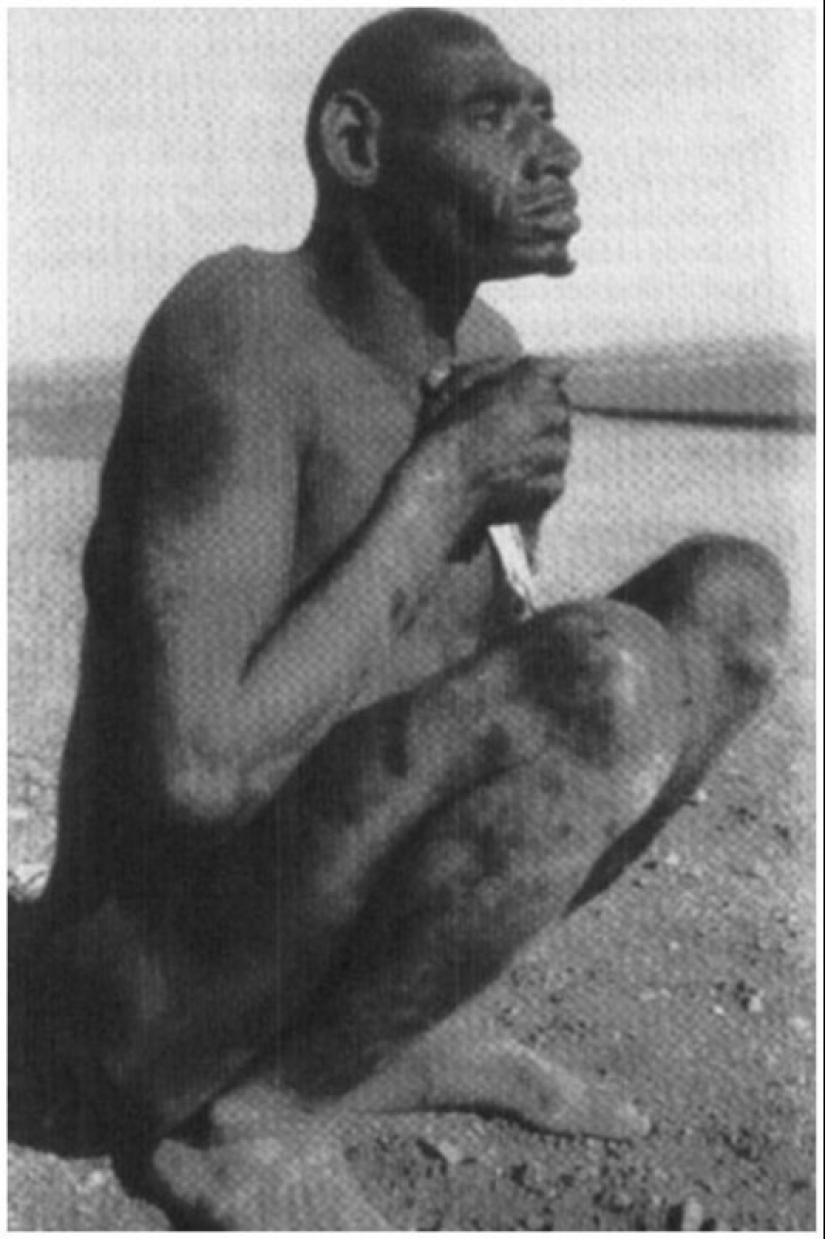 Was the 20th-century caveman Azzo Bassou a Neanderthal?